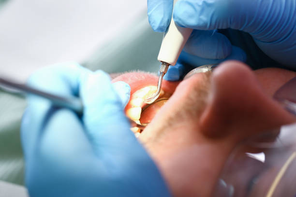 Best Weekend Emergency Dentist in East Mountain, TX