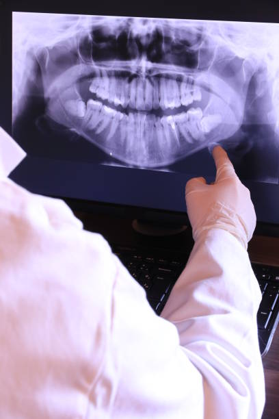 Best Emergency Dentist for Lost Fillings or Crowns in East Mountain, TX